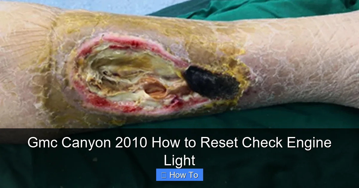 Gmc Canyon 2010 How to Reset Check Engine Light