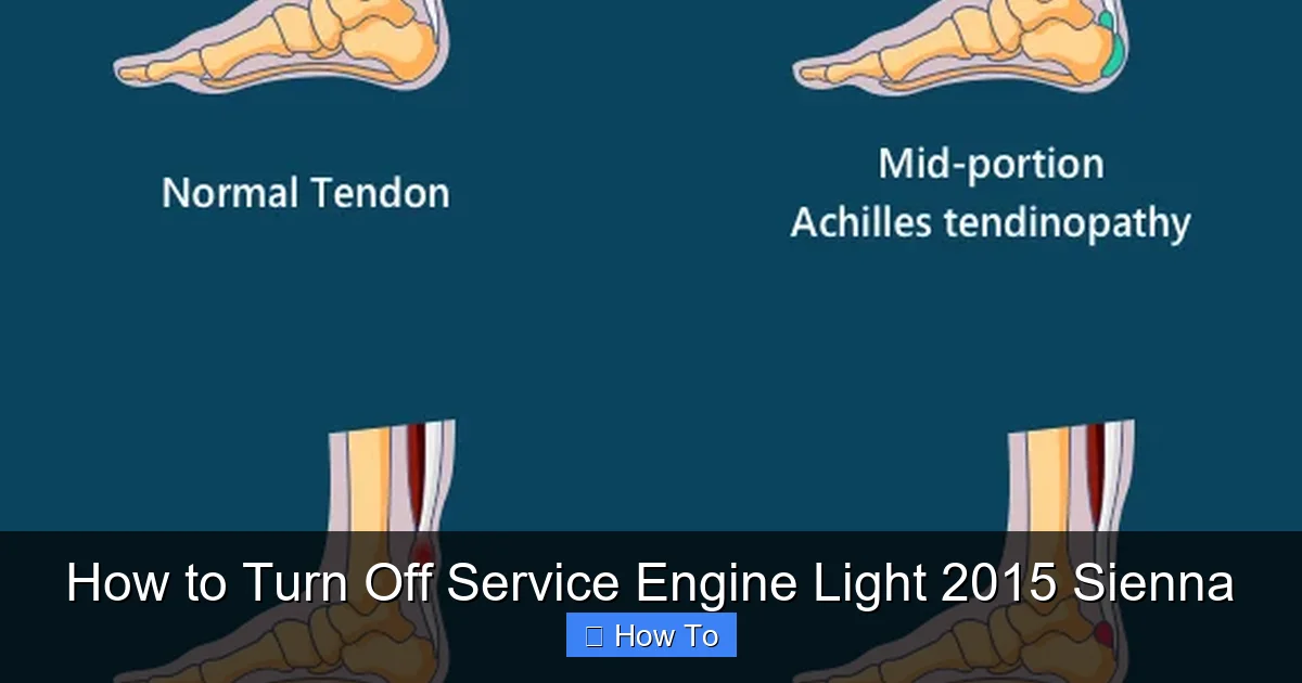 How to Turn Off Service Engine Light 2015 Sienna