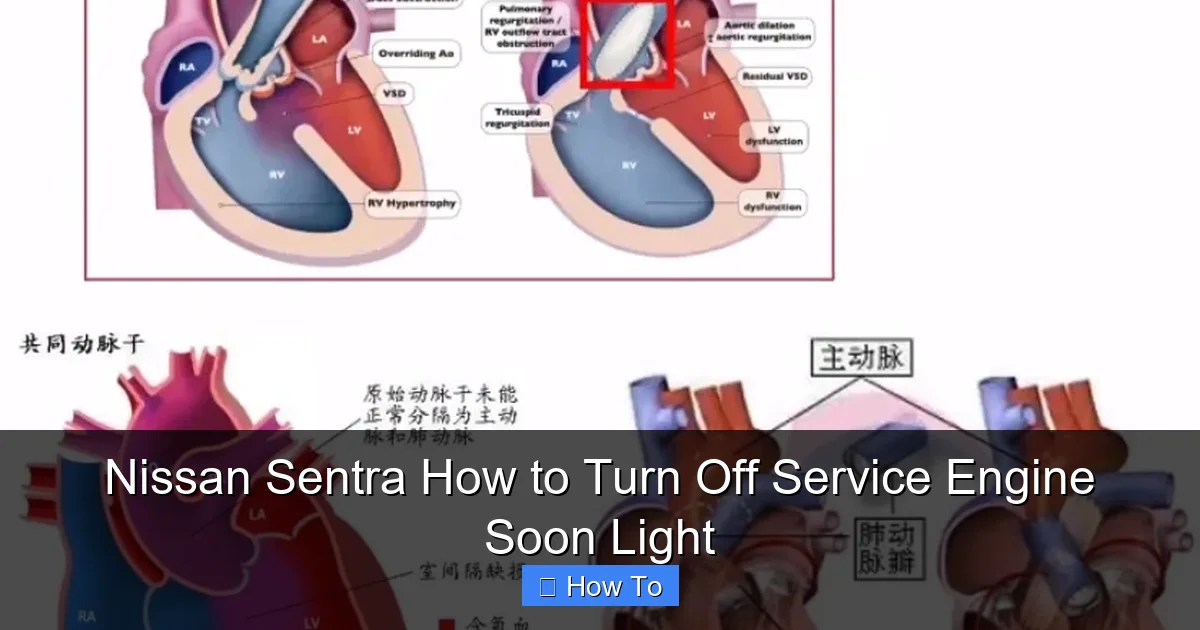 Nissan Sentra How to Turn Off Service Engine Soon Light